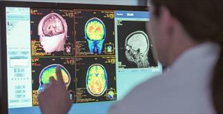 A healthcare provider reviewing brain CT scan images